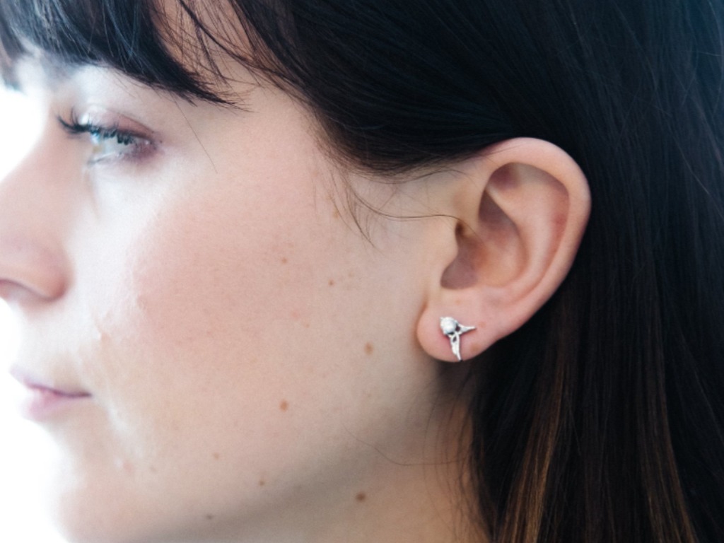 Wang met acne voor en na Cool Jet Plasma